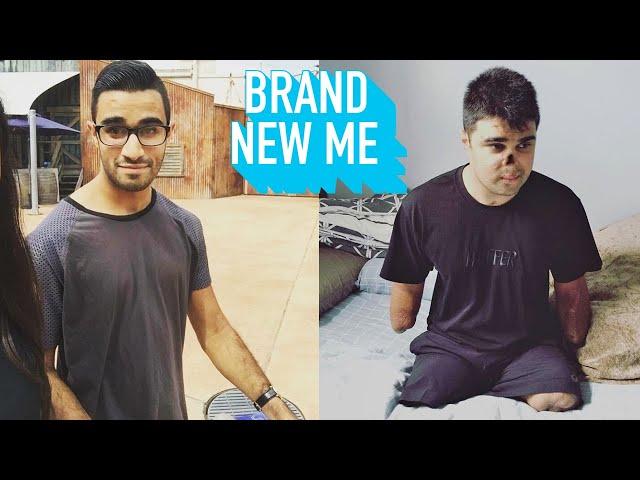 I Lost My Limbs When I Was 21 | BRAND NEW ME