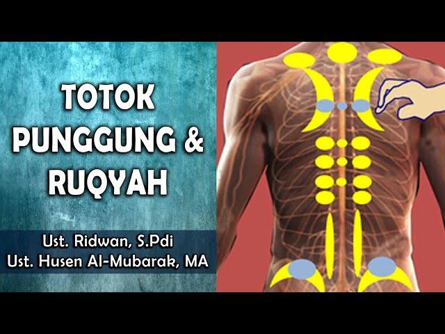 Totok Punggung & Ruqyah  ||  Ust. Ridwan, S.Pdi & Ust. Husen Al-Mubarak, MA