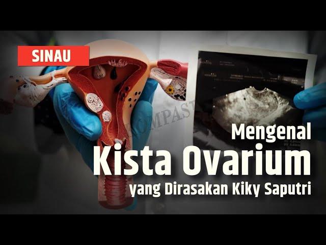 Apa Itu Kista Ovarium yang Dialami Kiky Saputri, Begini Penjelasannya | SINAU