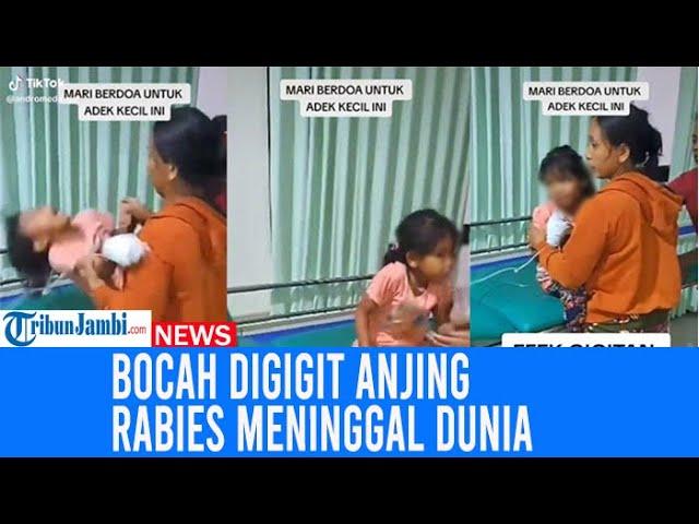 Viral Bocah Digigit Anjing Rabies Meninggal Dunia, Kejang-Kejang Saat Diberi Minum