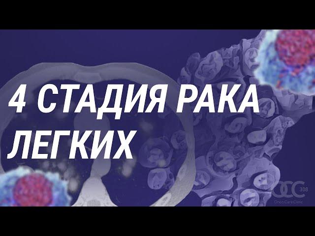 4 стадия рака легких. Как жить дальше?