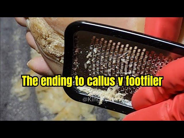 CALLUS V FOOTFILER PT4