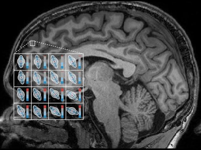 Introduction to Diffusion-Weighted MRI and Microstructure Imaging