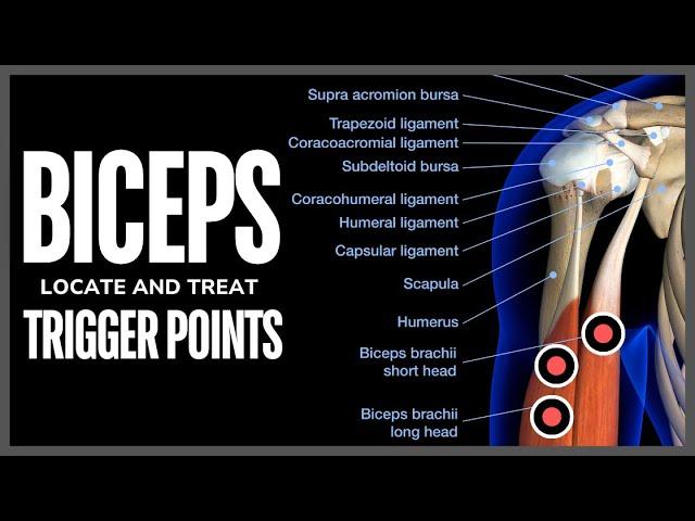 Understanding Trigger Points in the Biceps Muscle