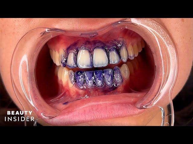 Purple Teeth Stains Can Temporarily Brighten Yellow Stains | Beauty Insider