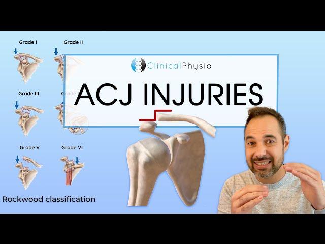 Acromioclavicular Joint Injuries | Expert Physio Review