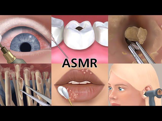 Care Animation Collection 2(no music) Eye, cavity,lip, ear Care | 케어 애니메이션 모음집2 | 눈, 치아, 귀, 입술