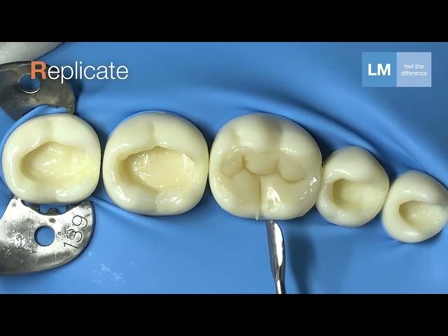 LM-Arte™ Replica Posterior - making occlusal modeling fast, simple and predictable