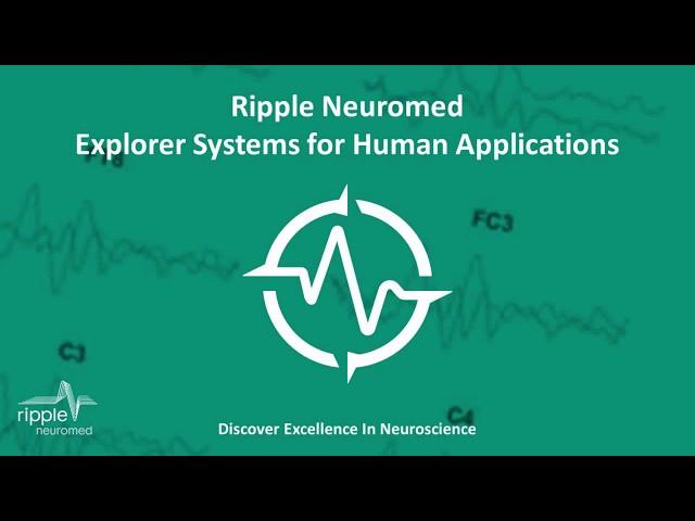 The Explorer Product Line for Human Neuroscience