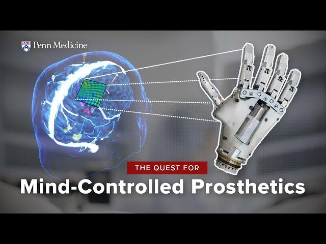 Thought-Controlled Prosthetics: A Brain-Computer Interface Breakthrough