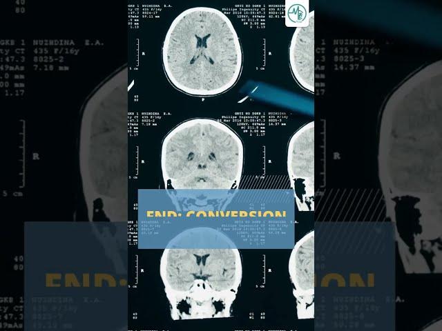 Functional Neurologic Disorder (FND) | #MCAshorts