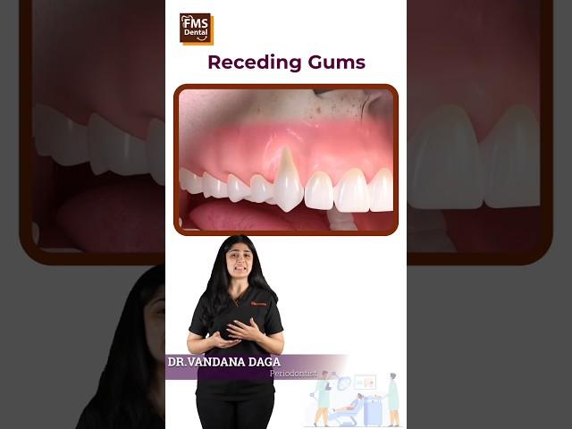 Can you fix receding gums? why does this happen? Dentistry dental gum myths | FMS Dental