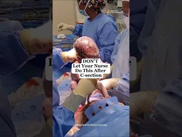 Don’t  Let Your Nurse Do THIS After C-Section! #csection