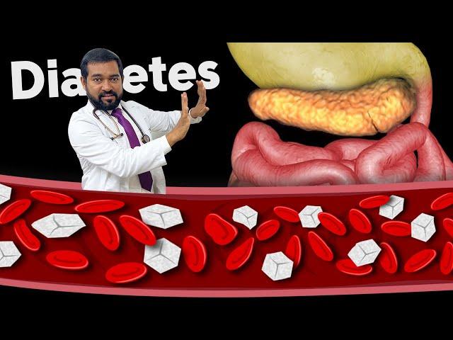 Reversing diabetes type 1 and type 2 with following simple guidelines | Diabetes Care | Dr haque