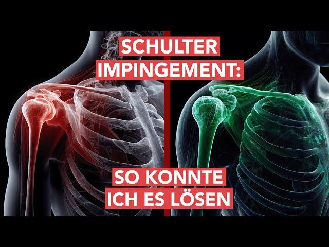 Schulter Impingement: Das hat mir geholfen - So konnte ich es loswerden