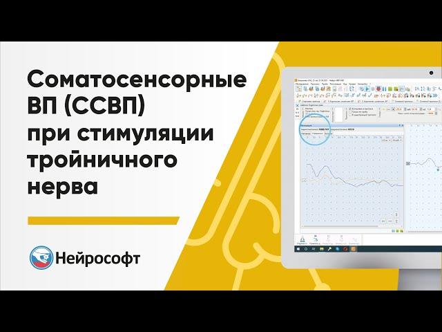 Соматосенсорные вызванные потенциалы (ССВП) при стимуляции тройничного нерва