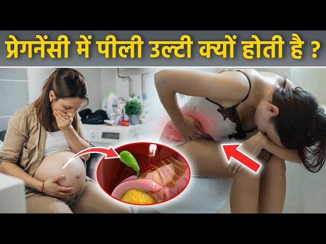 Pregnancy Yellow Vomit: Pregnancy Me Yellow Vomiting Hona, Reason & Treatment|Boldsky