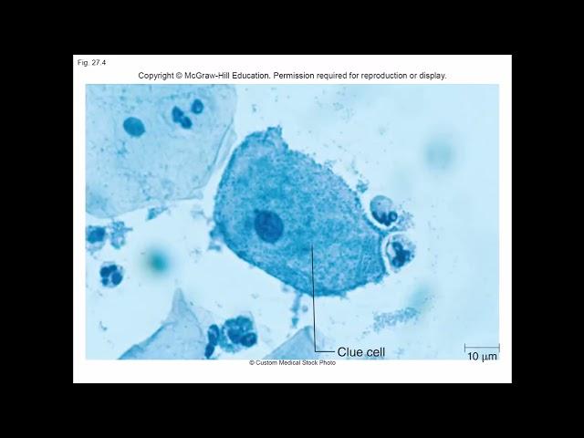 MICROBIOLOGY- GENITOURINARY INFECTIONS AND HIV/AIDS