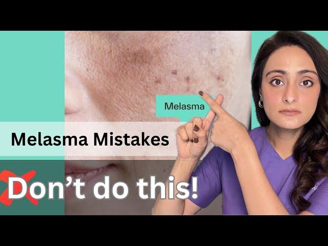 Melasma | Common mistakes | How to treat | Dermatologist