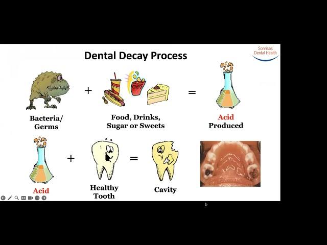 Teeth Health & How It Affects Your Body