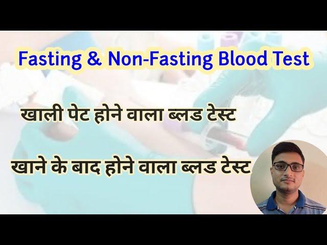 Fasting and Non Fasting Blood Test | Full List | खाली पेट और खाने के बाद होने वाला ब्लड टेस्ट