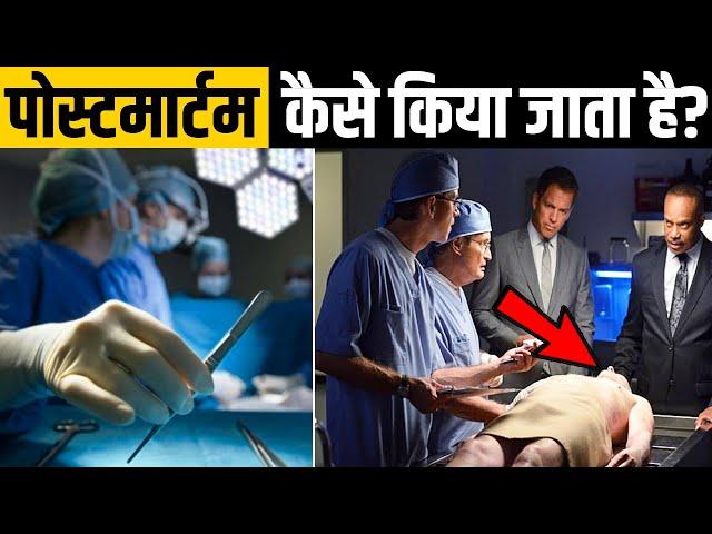 देख लो कैसे करते हैं Doctors Post Mortem ! How Autopsy Procedure is Done In Hospitals?