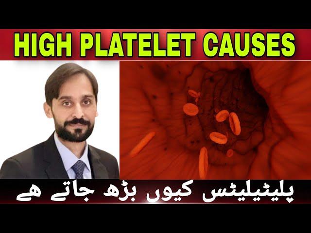 High Platelet Count | Causes of High Platelet in Blood