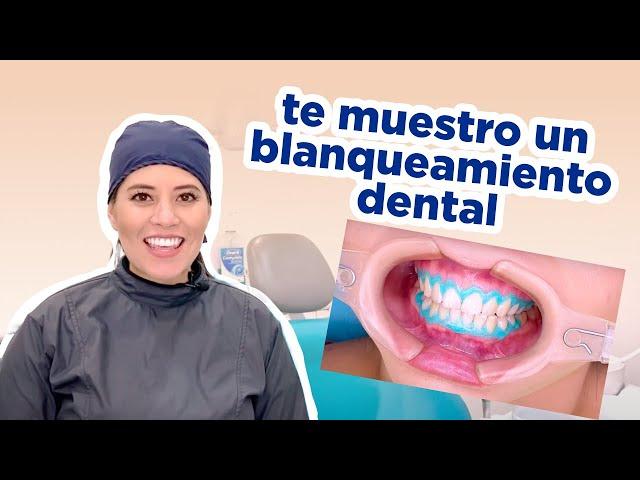 BLANQUEAMIENTO DENTAL / COMO LO HACEMOS