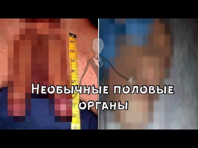 10 людей с необычными половыми органами