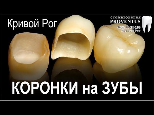 Коронка на зуб: сколько стоит поставить коронку (цена в г. Кривой Рог, Украина)