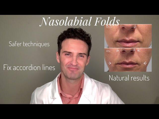 Nasolabial Folds & Accordion Lines: A Tutorial