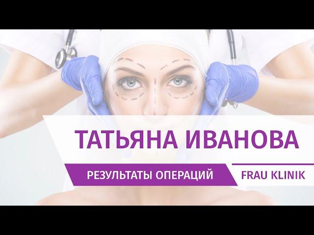 Татьяна Иванова через год после проекта