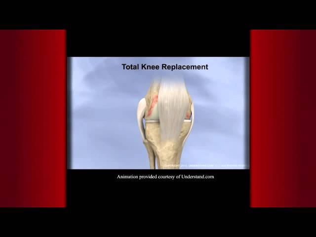 FOX Sports Keck Medicine of USC Report: Total Knee Replacement