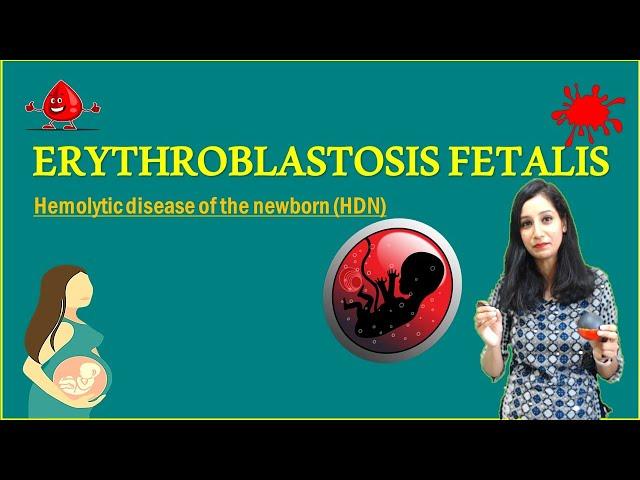 ERYTHROBLASTOSIS FETALIS II Hemolytic disease of the newborn (HDN)