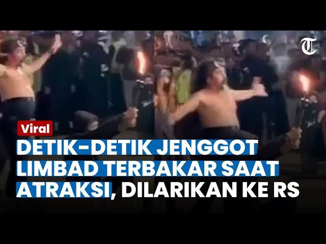 Atraksi Sembur Api, Jenggot Master Limbad Terbakar Hingga Harus Dioperasi