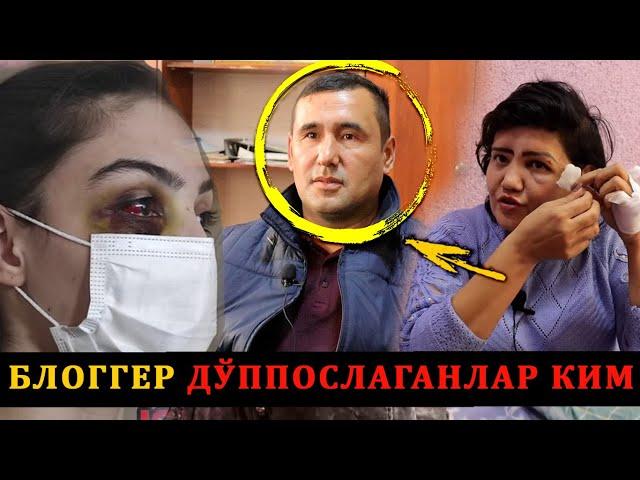 БЛОГГЕРНИ ЗЎРЛАБ ДУППОСЛАГАН ЭЛЕКТРА СВЕТ РАХБАРИМИ ? СЕКРЕТ ВИДЕО ТАРҚАЛДИ...