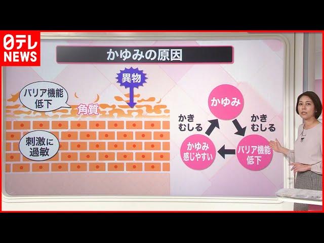 【解説】かゆみに“粉ふき”…ただの乾燥ではなく「皮脂欠乏症」  暖房との“距離”を意識『知りたいッ！』