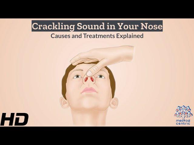 Crackling Noise in Your Nose? Discover the Triggers and Solution