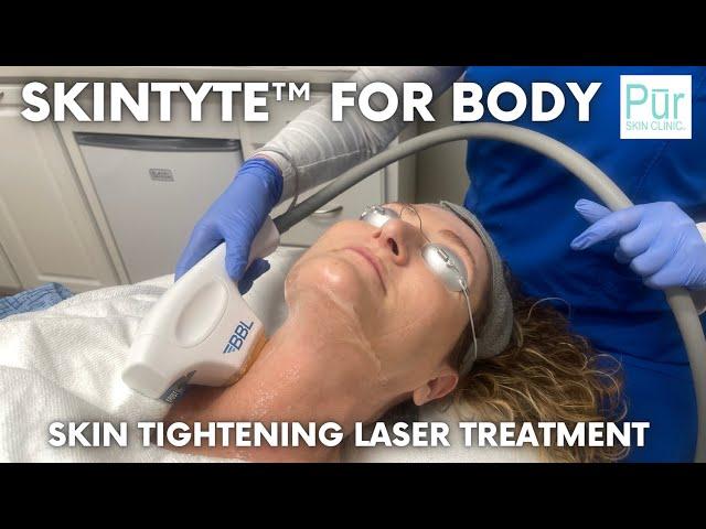 What is SkinTyte For Body? | Skin Tightening Laser Skin Treatment For Sagging Skin | Pūr Skin Clinic