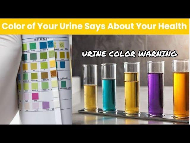 10 Shocking Facts About Urine Color | That Will Change Your Life! #urine #urineproblem #health