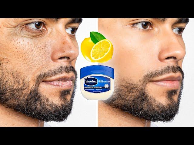 How To Fix Your Skin Problems For Men Over 30