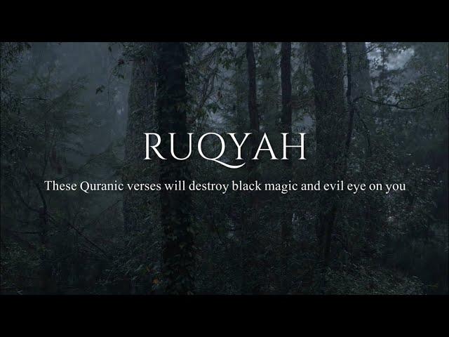 RUQYAH - Spiritual Treatment For Black Magic, Jinn & Evil Eye | Omar Hisham Al Arabi @qadrirecordss