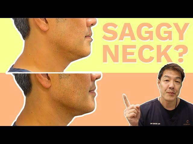 All the ways to treat Neck Laxity | Dr Davin Lim