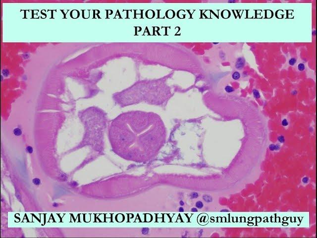 Test Your Pathology Knowledge, Part 2