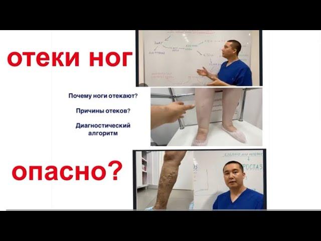 #Отеки ног : как определить причину