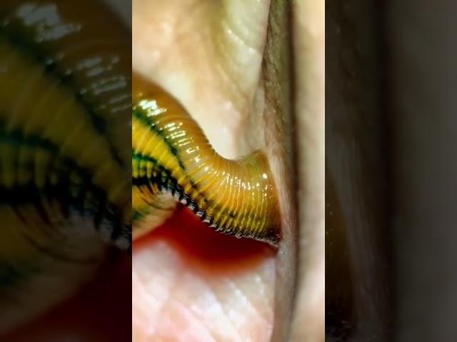 Leech bite under the microscope!