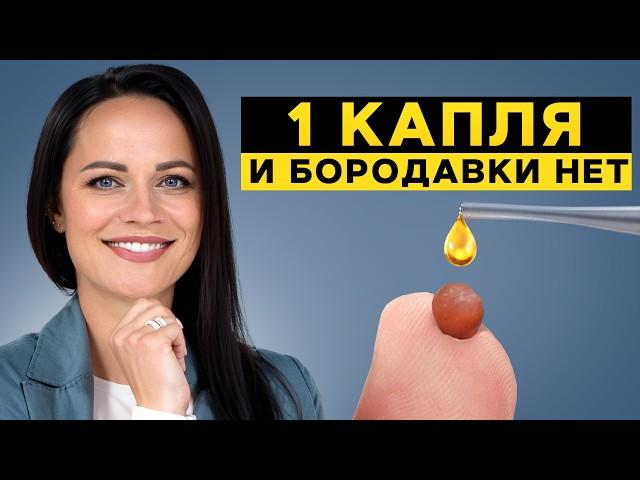 Удаление БОРОДАВОК дома – ПРОСТО! / Как навсегда избавиться от бородавок с помощью эфирных масел?