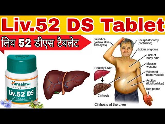 Himalaya Liv 52 DS tablet review in hindi | Himalaya Liv 52 ds uses, dosage | Liv 52 uses in hindi |