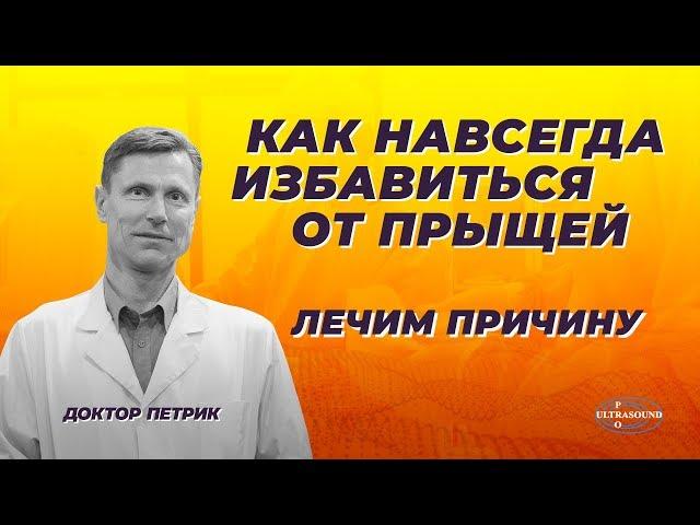 Как избавиться от прыщей. Лечим причину.