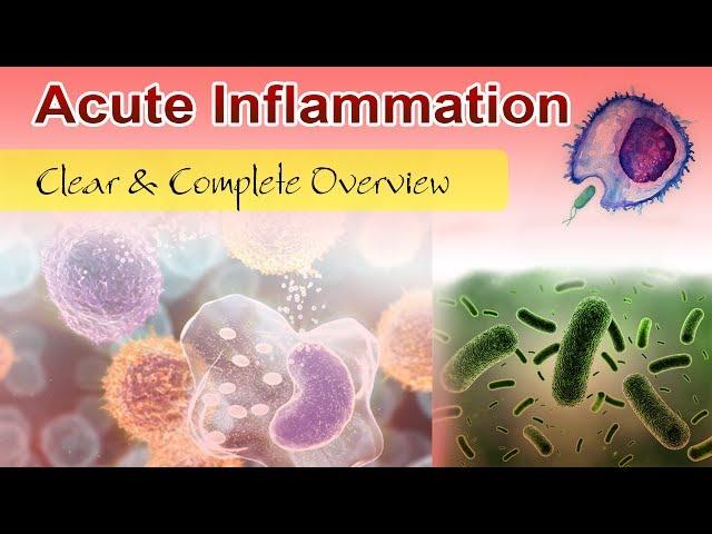 Acute Inflammation ( Clear & Complete Overview )